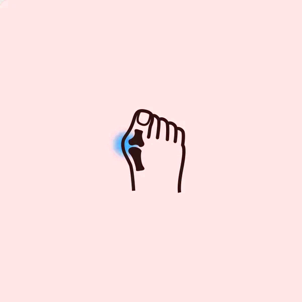مناسب پنجه پهن